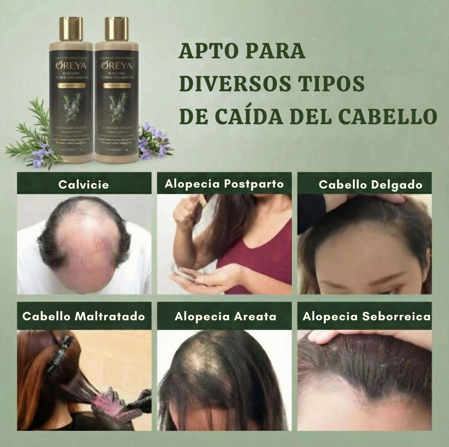 Oreya™ Growth Support Shampoo El secreto para un cabello más largo, fuerte y saludable.