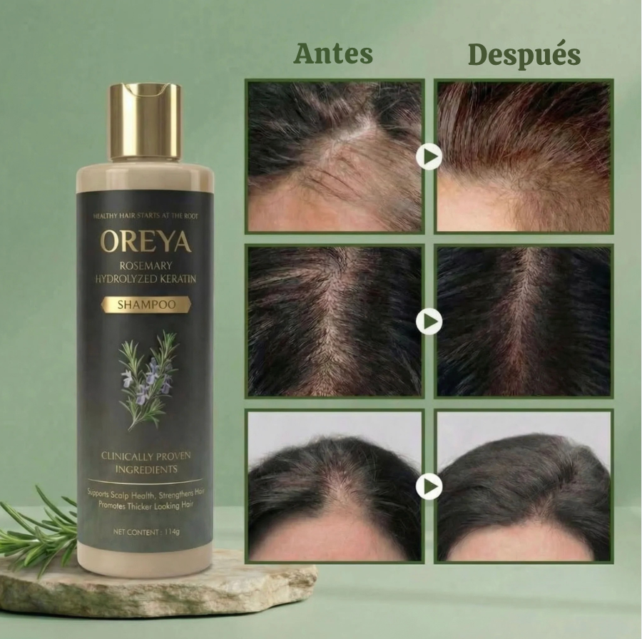 Oreya™ Growth Support Shampoo El secreto para un cabello más largo, fuerte y saludable.
